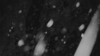 Ski areál U Sachovy studánky