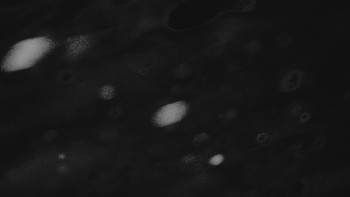 Ski areál U Sachovy studánky