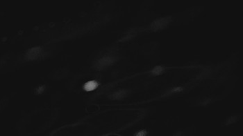 Ski areál U Sachovy studánky