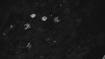 Ski areál U Sachovy studánky