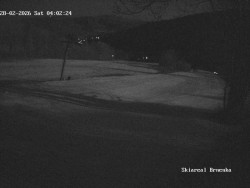 Sjezdovka, Vernířovice